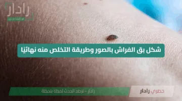 شكل بق الفراش بالصور وطريقة التخلص منه نهائيًا