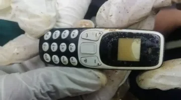 مصري يبتلع هاتفًا ويبقى في معدته عامين قبل استخراجه