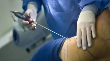 حصريًا عملية تجميل فاشلة تهز الجزائر ما السبب وراء حبس الطبيب