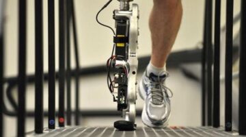 تفاوت ملحوظ في تكلفة الأطراف الصناعية في مصر لتلبية احتياجات ذوي الهمم متنوعة الاختيارات