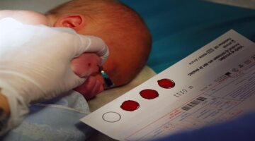 هل يشمل معاش تكافل وكرامة الأطفال المصابين بمرض PKU الوراثي؟