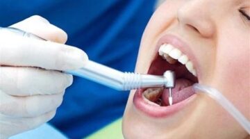 تطور جديد بشأن ترخيص أجهزة الأشعة في العيادات وموقف النقابة من النيتروز