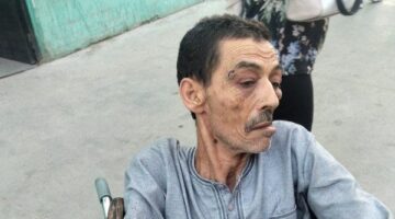 تقرير طبي يكشف تفاصيل إصابات مسن تعرض للاعتداء بسبب خلافات نسب بحلوان